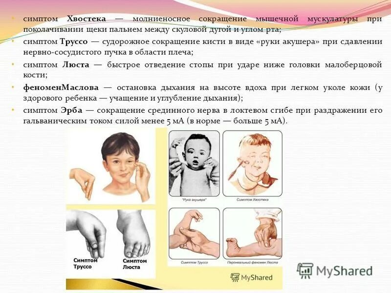 судорожная готовность. симптом хвостека. положительные симптомы хвостека и труссо. хвостека и труссо являются признаками. принципы нейрореанимации.