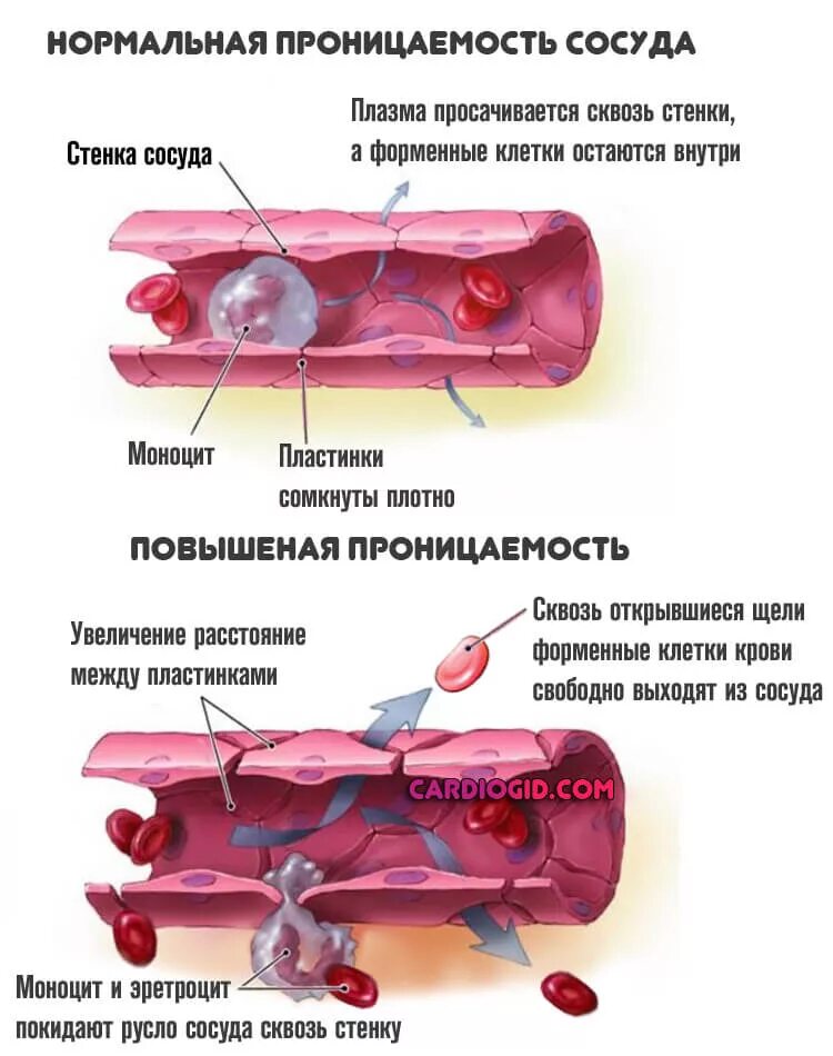 Почему из члена кровь. Повышенип проницаемости со. Повышенная проницаемость сосудов. Повышение сосудистой проницаемости. Проницаемость стенок сосудов.