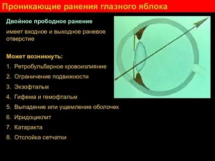 Защита от механических повреждений глаза