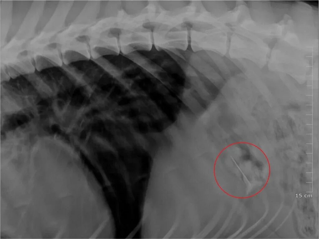 Инородные тела на рентгенограмме. Ребенок проглотил симптомы. Как понять что проглотил инородный предмет. Предметы проглоченные детьми. Монета в желудке рентген.