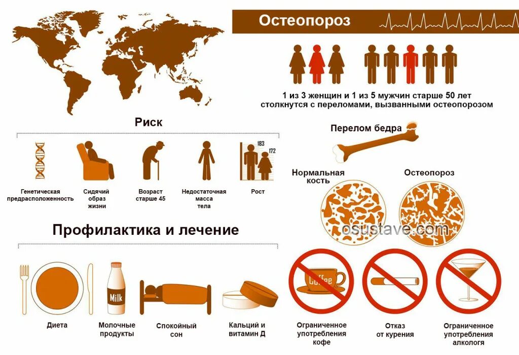 Причины остеопороза у женщин после 60. Причины остеопороза у женщин после 60. Остеопороз позвоночника. Профилактика остеопороза картинки. Постменопаузальный остеопороз.