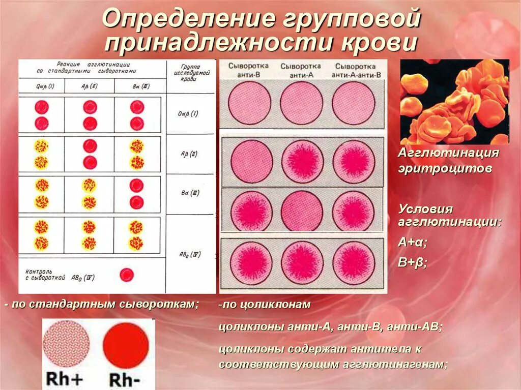 Методика определения групповой принадлежности крови. Определение группы крови. Группы крови агглютинация. Группы крови стандартными сыворотками. Эритроцитарные группы крови