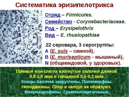 Возбудитель рожи