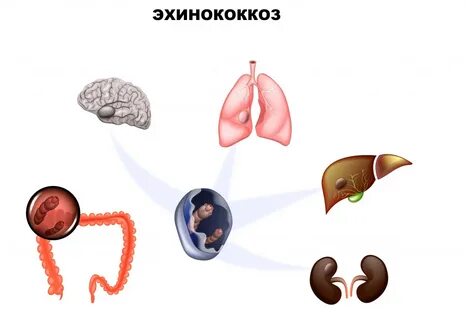 Аскаридоз и эхинококкоз