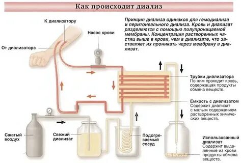 Механизм диализа
