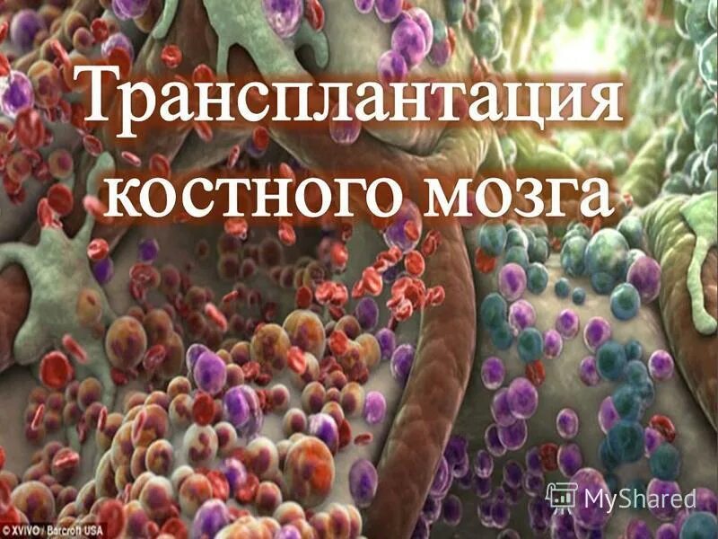 Пересадка костного мозга что это