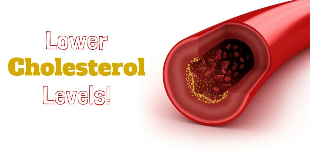 Cholesterol levels. Cholesterol level.