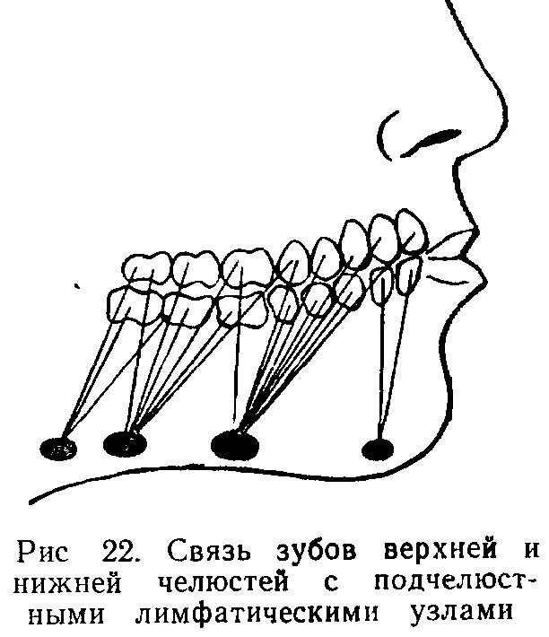 Лимфатический узел челюсть. Строение челюсти и лимфоузлов. Лимфатические узлы на челюсти схема. Лимфоузлы под челюстью схема расположения. Лимфатические узлы нижней челюсти.