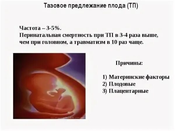 Предлежание плода 32 недели. 31-32 Неделя беременности тазовое предлежание. 27 Недель тазовое предлежание. Предлежание плода в матке. Тазовое предлежание на УЗИ.