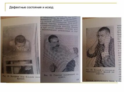 Брат болен шизофренией