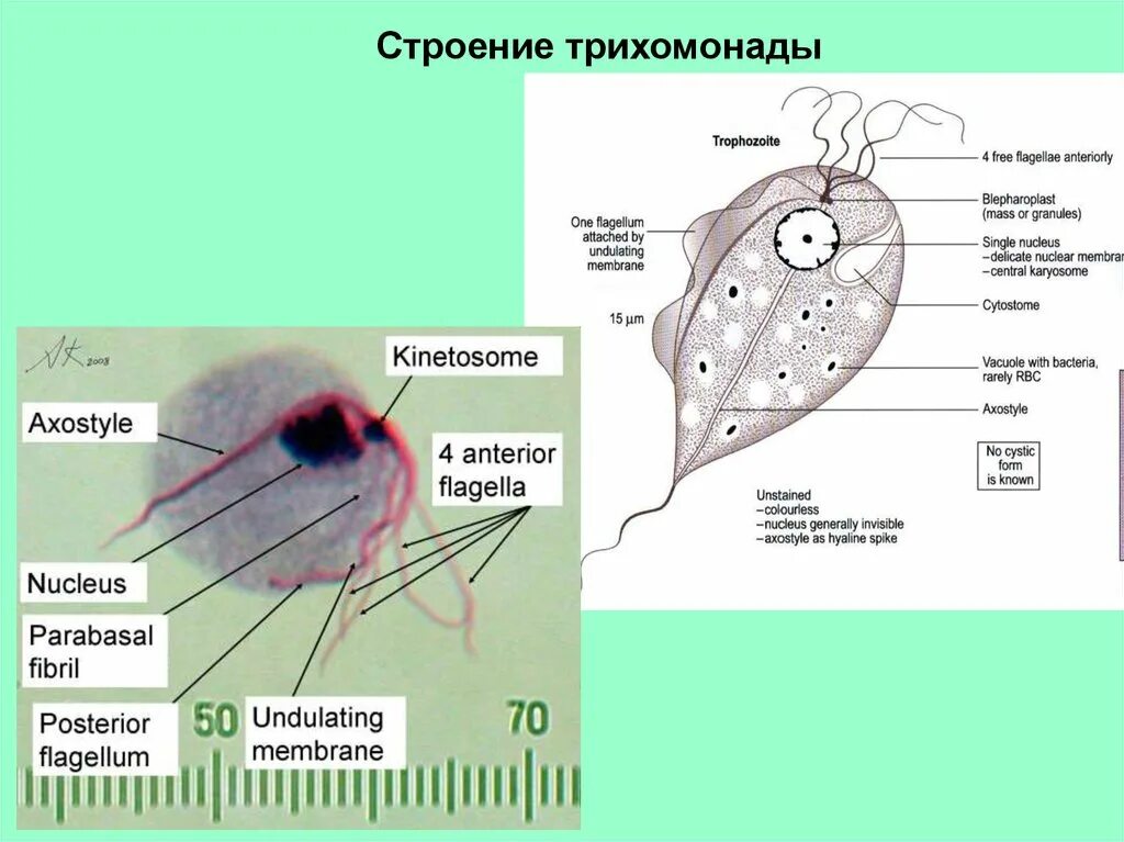Трихомонада строение. Трофозоит трихомонады. морфология влагалищной трихомонады. ротовая трихомонада строение.
