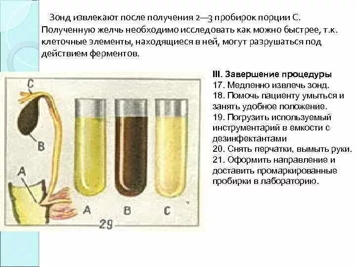 Желчь в пробирке. Дуоденальное зондирование порция а в пробирке. Желудочное зондирование пробирки. Дуоденальное зондирование пробирки.
