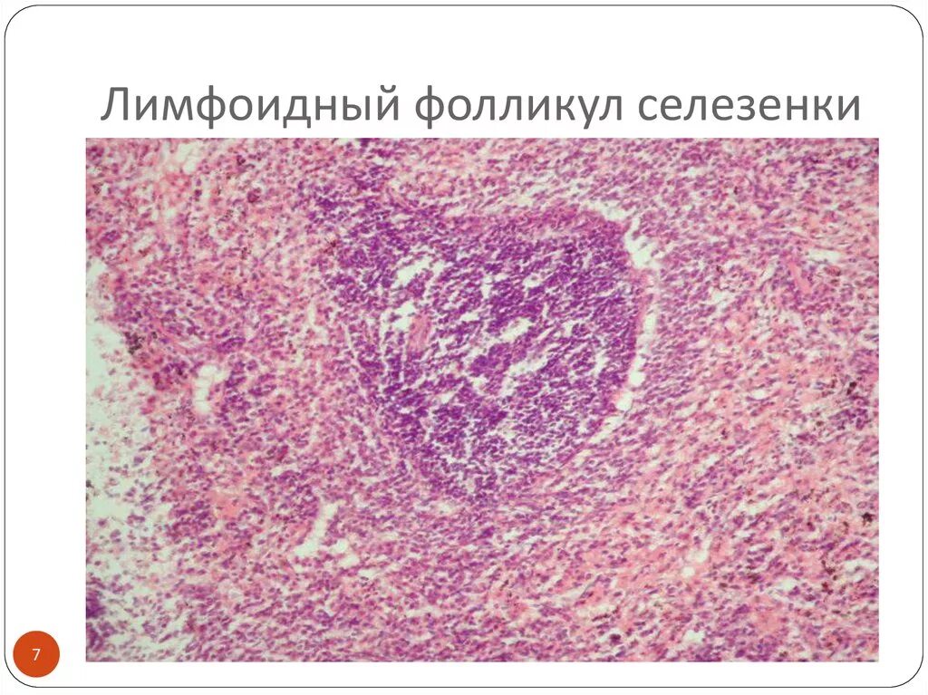 Лимфатический фолликул селезенки гистология. Строение лимфоидного фолликула лимфатического узла. Лимфоидные фолликулы функции. Зоны лимфатического узелка селезенки. Лимфоидные узелки селезенки.