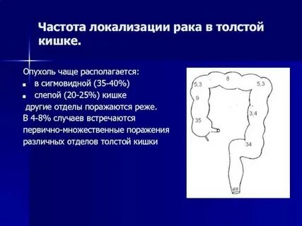 Сигмовидная кишка код по мкб 10