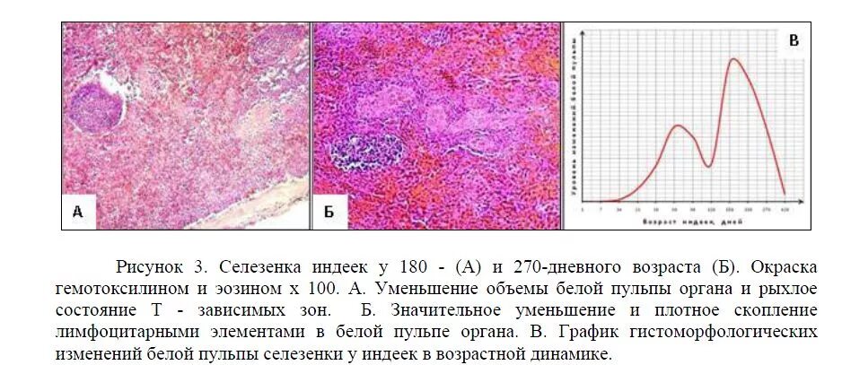 Возрастные изменения селезенки гистология. Развитие селезенки гистология. Возрастные изменения пульпы.