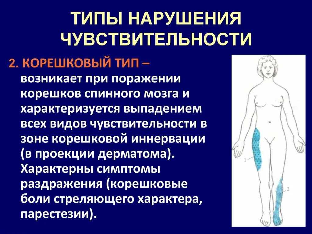 Сегментарный диссоциированный тип нарушения чувствительности. Периферический тип нарушения чувствительности. корешковые расстройства чувствительности. периферический тип чувствительных расстройств. типы чувствительных нарушений.