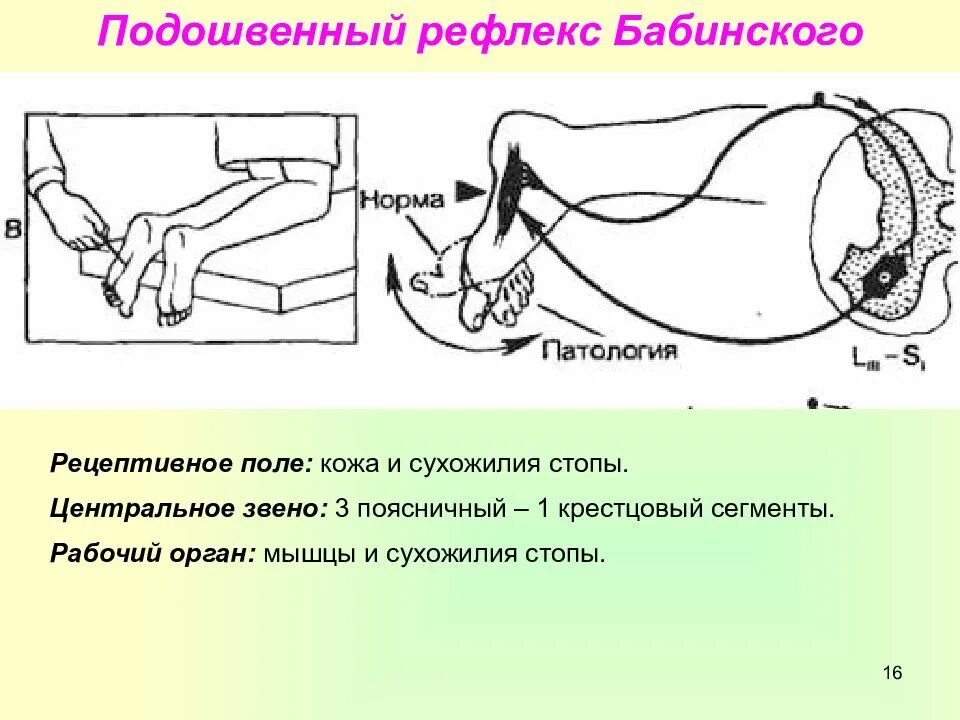 Рефлекс три. Подошвенный рефлекс бабинского. подошвенный рефлекс бабинского схема. схема рефлекторной дуги подошвенного рефлекса. подошвенный рефлекс рефлекторная дуга.