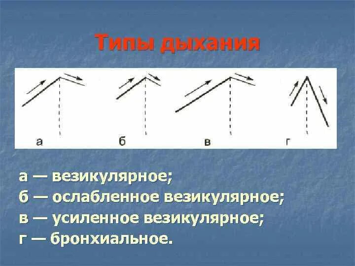 Везикулярное и бронхиальное дыхание. Типы дыхания везикулярное бронхиальное. Везикулярное дыхание схема. Пуэрильное везикулярное и бронхиальное дыхание.