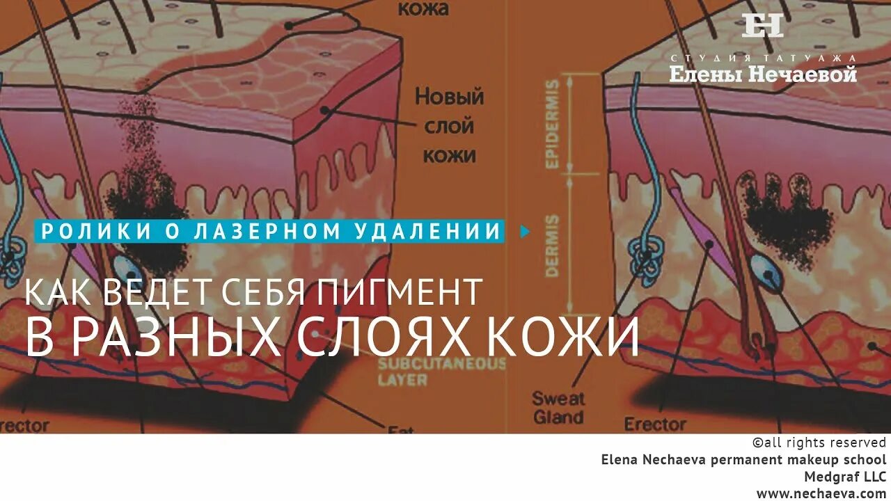 Для кожи нечаева. Введение пигмента в кожу. Глубина введения пигмента в кожу. Строение кожи татуаж.