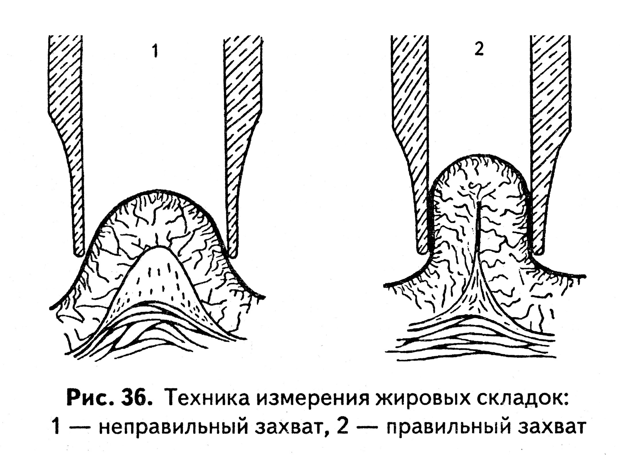 Нормальная складка