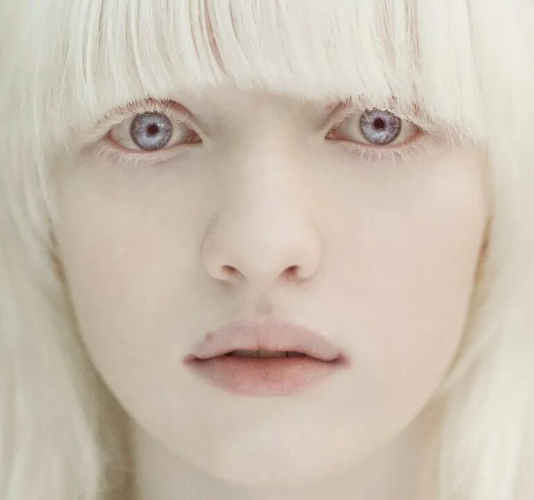 Страдающий альбинизмом. Настя Жидкова альбинос. Настя Жидкова модель. Настя Кумарова.