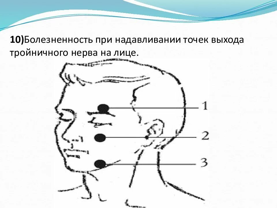 Точки болезненности. Точки Валле тройничного нерва. Пальпация точек выхода ветвей тройничного нерва. Точки выхода тройничного нерва на лице пальпация. Невралгия тройничного нерва точки Валле.