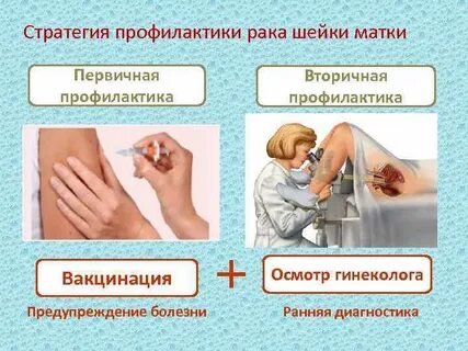 Профилактика шейки матки