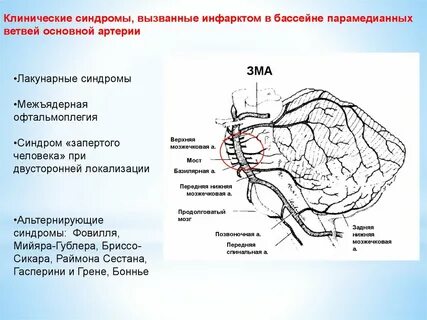 Бассейн основной артерии