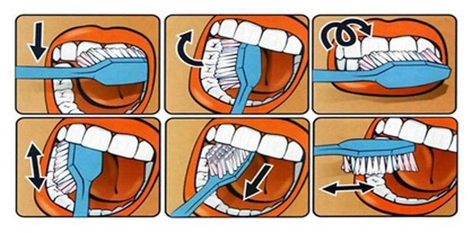 Метод басса чистка. Алгоритм чистки зубов. Схема чистки зубов. Стандартная техника чистки зубов. Правила чистки зубов для детей.
