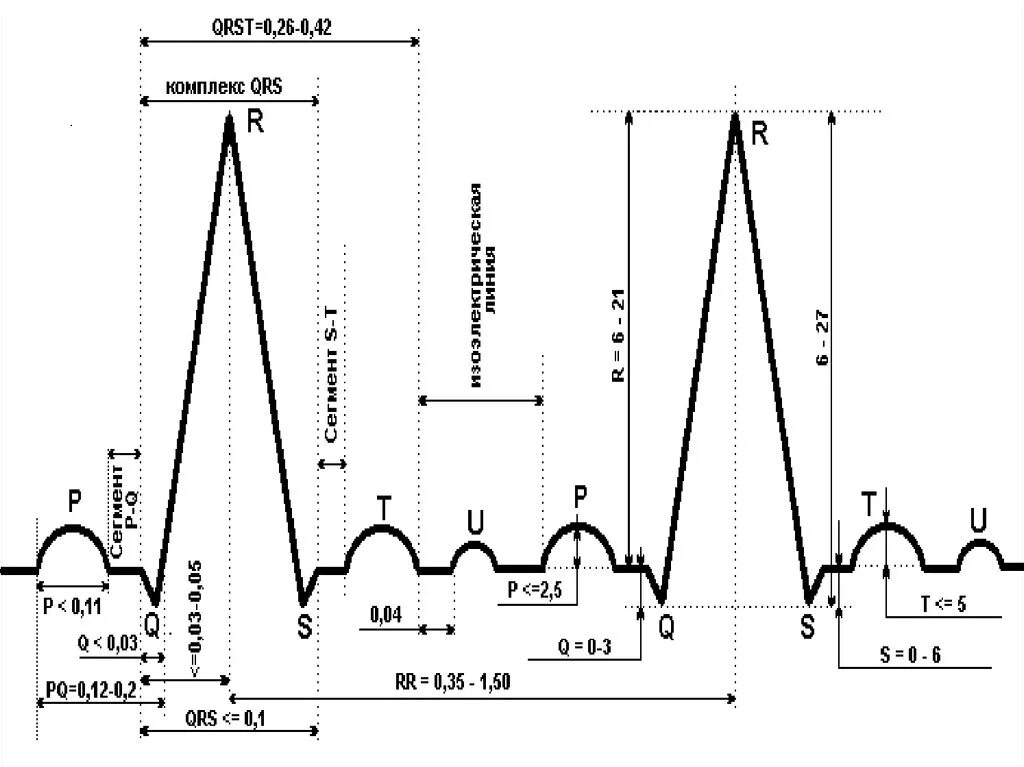 Схема зубцов ЭКГ. ЭКГ зубцы и интервалы. Сегмент PQ на ЭКГ. ЭКГ схема зубцы интервалы.