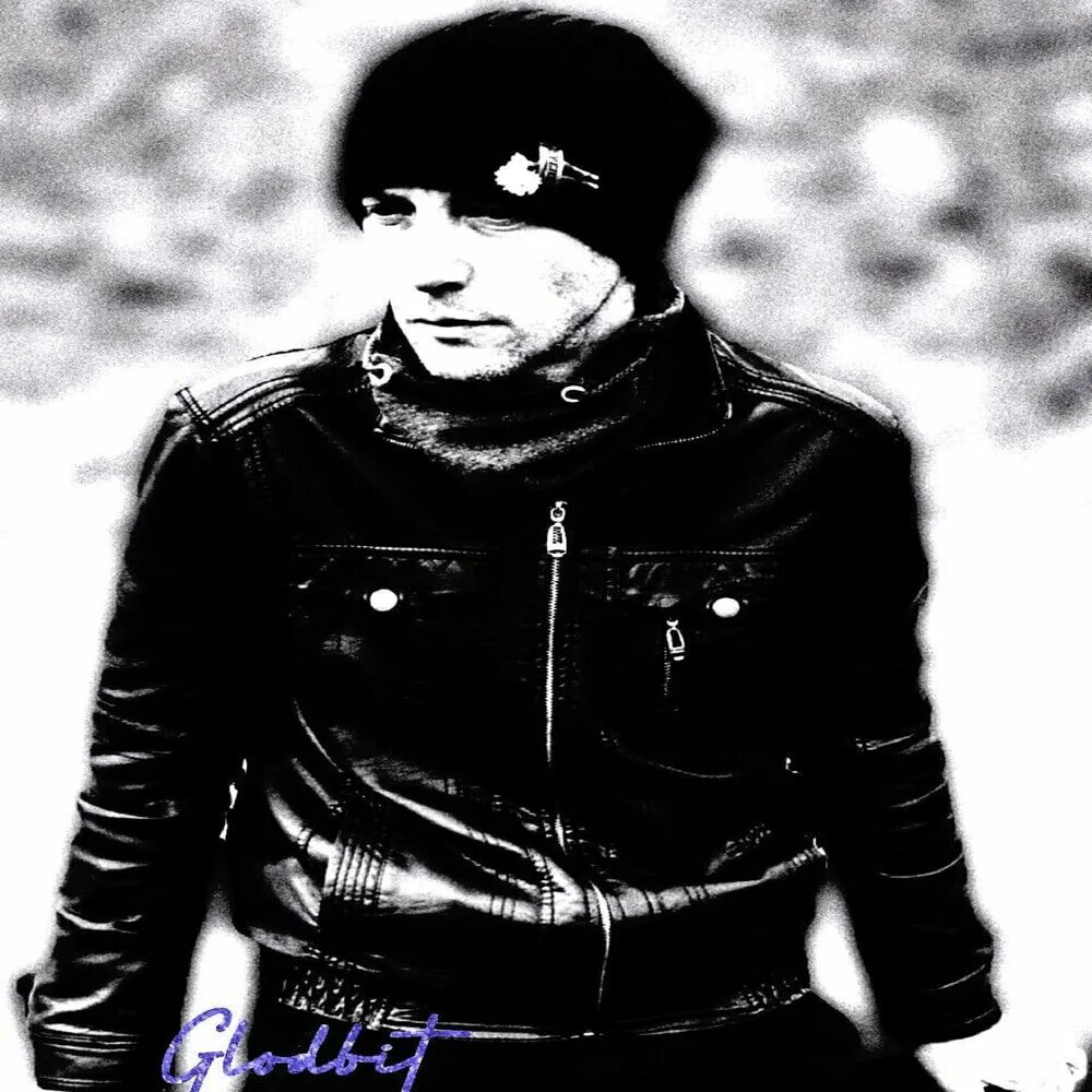 Glod. Платяная вошь педикулез. Glod bit. Головная вошь (pediculus humanus capitis). Вши под микроскопом на волосах.