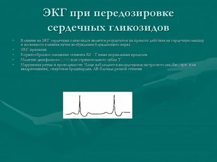 Интоксикация на экг
