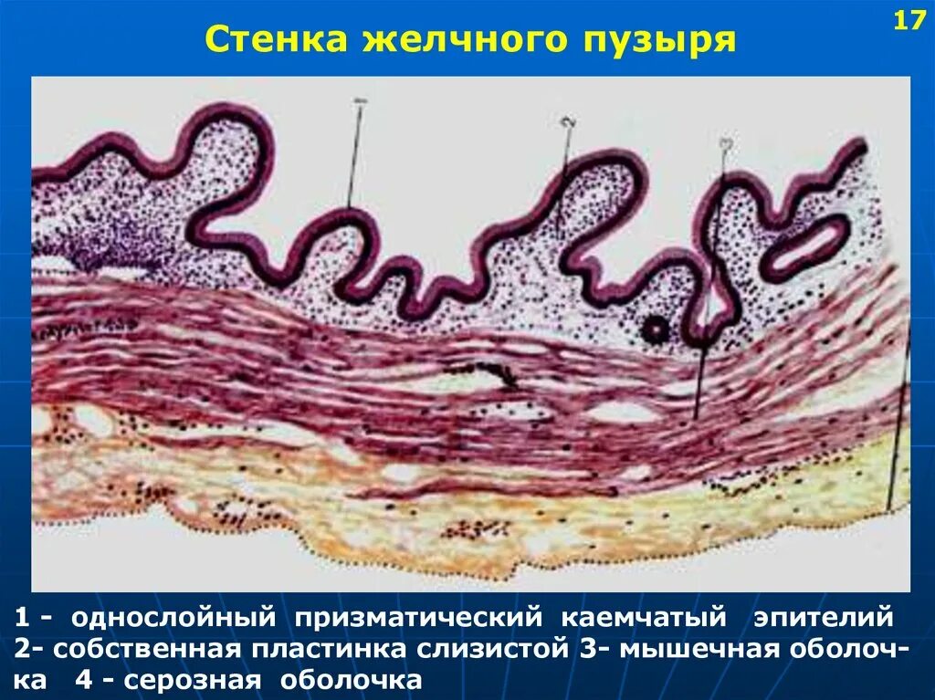 Слизистая оболочка желчного пузыря. Строение стенки желчного пузыря гистология. Желчный пузырь гистология препарат. Разрез стенки желчного пузыря гистология. Желчный пузырь человека гистология.