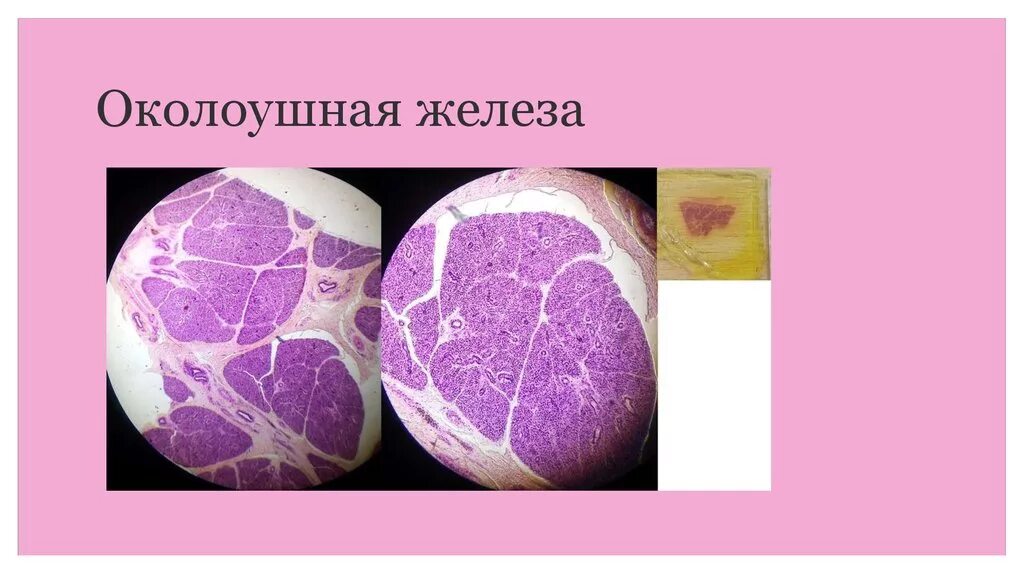 Околоушная гистология. Околоушная железа препарат с подписями. околоушная железа гистология препарат. околоушная слюнная железа гистология препарат. околоушная железа гистология рисунок.