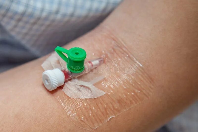 Catheter stock image. Image of drip, bladder, hospital - 48194111