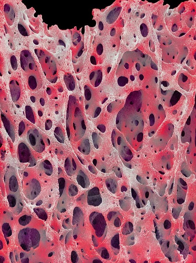 скелетные ткани человека. клетки костной ткани гистология. клетки кости под микроскопом. костная ткань микрофотография. костная соединительная ткань строение.