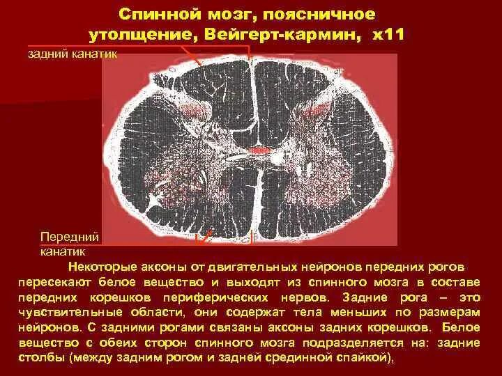 Поражение передних рогов. Поясничное утолщение спинного мозга. Боковые рога спинного мозга поясничное утолщение. Спинной мозг окраска по Вейгерту.