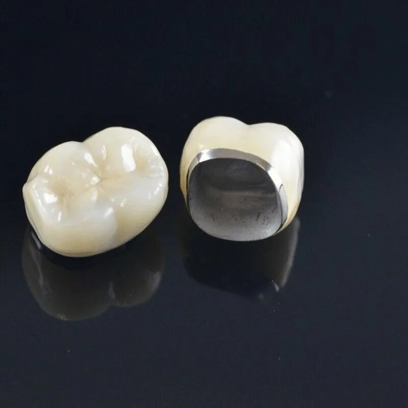 Металлопластмассовые цельнолитые коронки. Каркас металлопластмассовой коронки. Металлопластмассовые цельнолитые коронки. Металлокерамическая коронка ivoclar, каркас кобальт-хром. Металлокерамическая коронка (ivoclar германия).