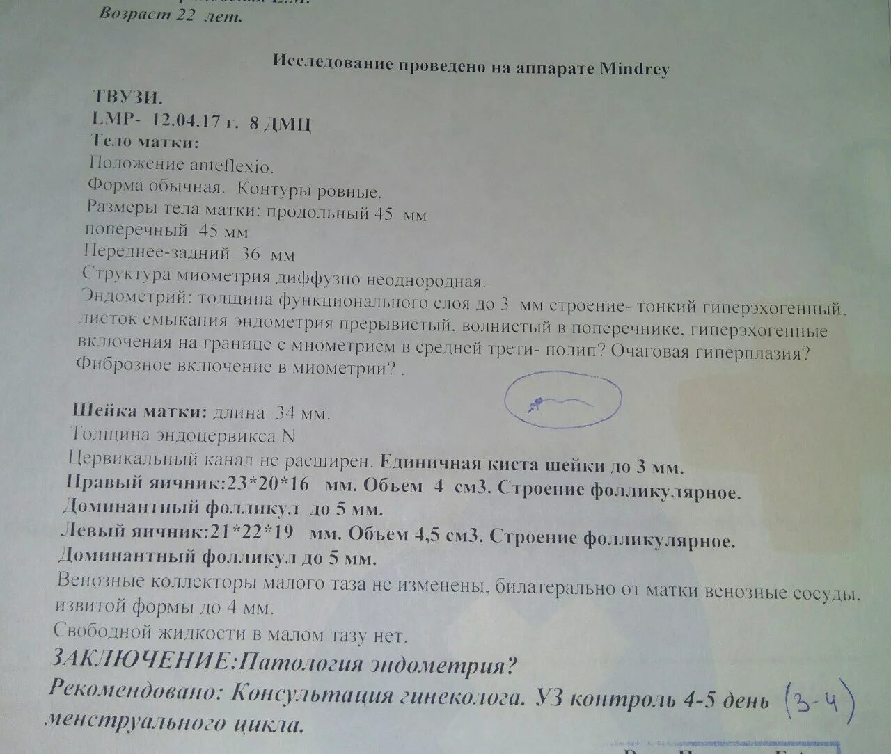 УЗИ на 5-7 день цикла. Эндометрий на 8 день цикла УЗИ. УЗИ на 8 день цикла. УЗИ по дням цикла. Фолликул яичника размеры