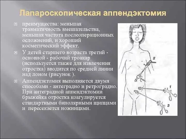 При аппендиците повышается