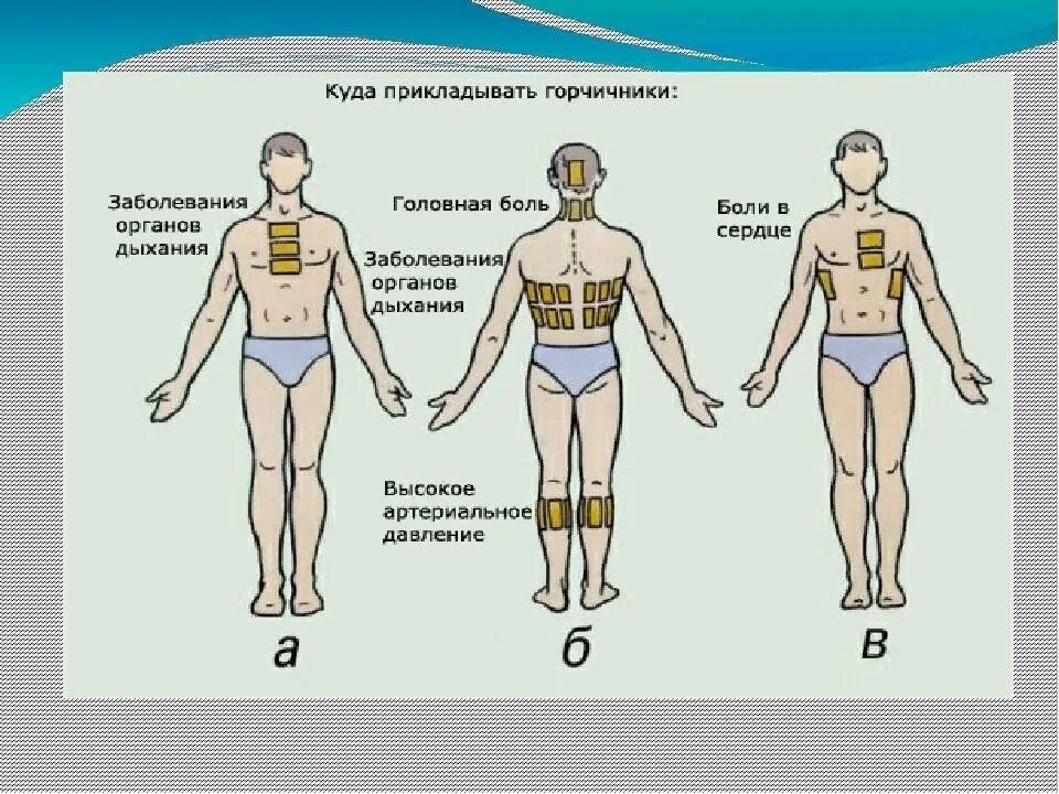 Можно при кашле ставить горчичники ребенку. Места постановки горчичников при кашле. Постановка горчичников на спину. Как ставить горчичники. Зона наложения горчичников.