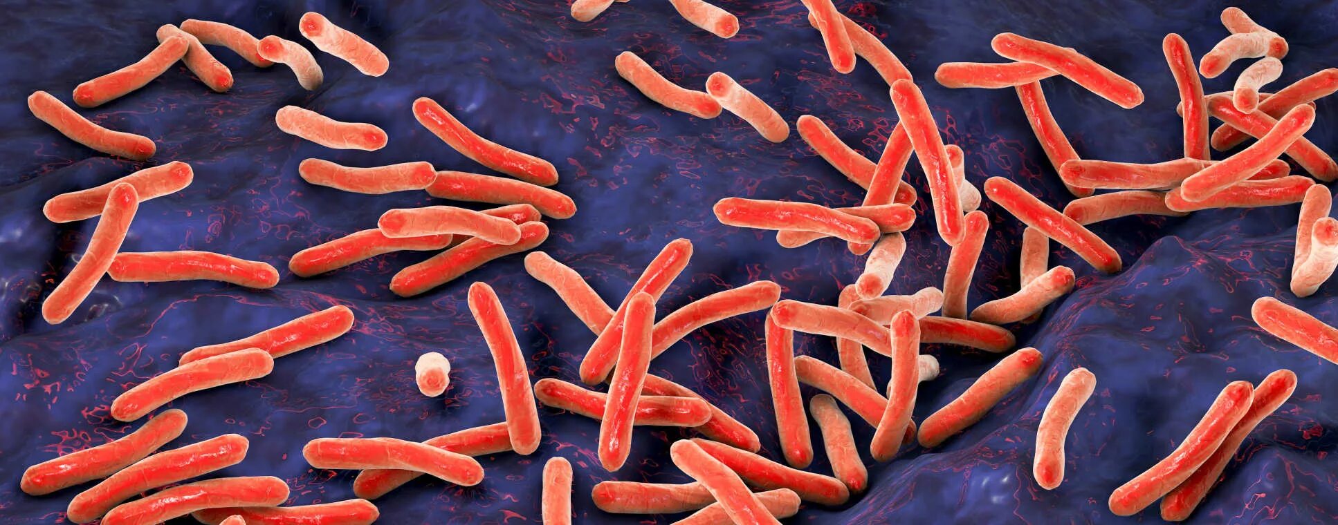Mycobacterium tuberculosis complex. Микобактериум туберкулезис. микобактерия палочки коха. палочка коха (mycobacterium tuberculosis). палочка коха возбудитель туберкулеза.