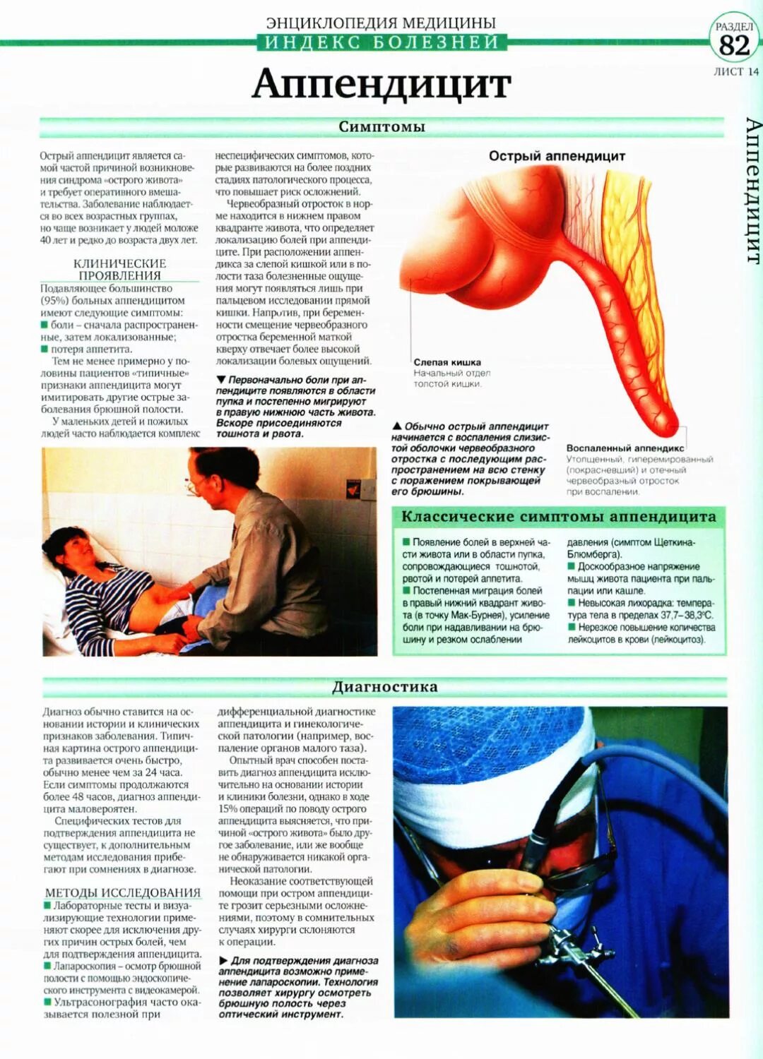 Что делать при подозрении на аппендицит. Санбюллетень острый аппендицит. Острый аппендицит брошюра. Памятка по острому аппендициту.