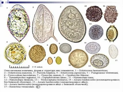 Размеры яиц глистов