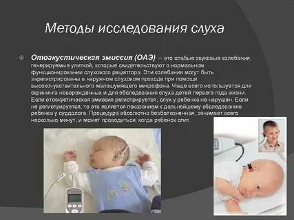 Отоакустическая эмиссия