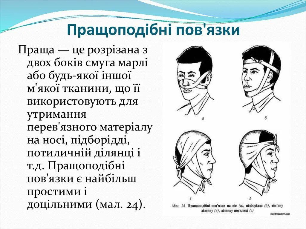 Причины пова. Праща повязка. Пращоподібна пов'язка на русском. Верхнегубная праща. Пов каллиский.