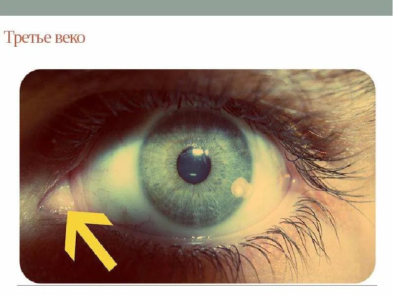 Полулунная складка (третье веко). Полулунная складка конъюнктивы. Полулунная складка (третье веко). Рудимент глаза человека. Рудимент глаза человека.