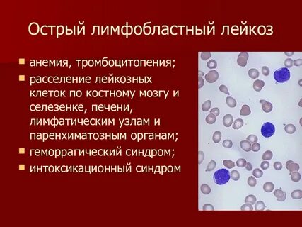 Тромбоцитопения анемия