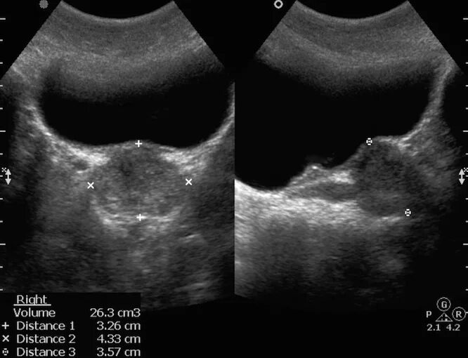 краснодар узи мочевого