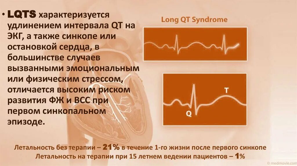 Увеличение интервала qt